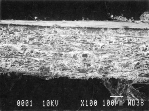 SEM Photomicrograph